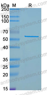 Recombinant Human SMAD4 Protein, C-His