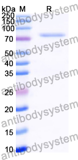 Recombinant Human BIRC2 Protein, N-His