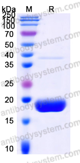 Recombinant Human PPP1R1A Protein, C-His