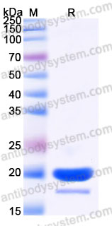 Recombinant Human EIF4EBP1 Protein, N-His