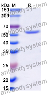 Recombinant Human NEUROD1 Protein, N-His-KSI