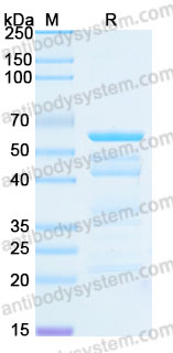 Recombinant Human IRF5 Protein, C-His