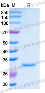 Recombinant Human TDG Protein, N-His