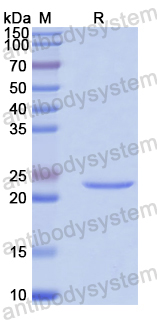 Recombinant Human SNW1 Protein, N-His
