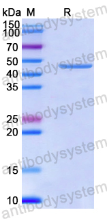 Recombinant Human SNX1 Protein, N-His
