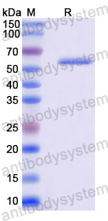 Recombinant Human MTMR2 Protein, N-His
