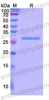 Recombinant Human CUL2 Protein, N-His
