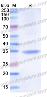 Recombinant Human CUL4A Protein, N-His-SUMO & C-Strep