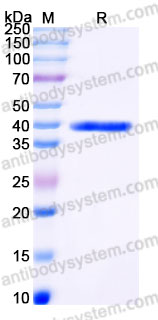 Recombinant Human GFUS Protein, C-His