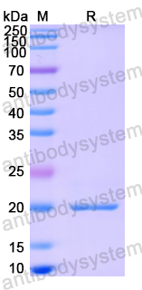 Recombinant Human RAB31 Protein, N-His