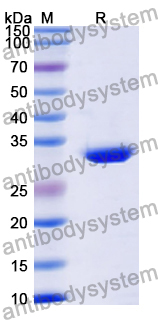 Recombinant Human HTR4 Protein, N-His-KSI