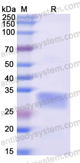 Recombinant Human FHL1 Protein, N-His