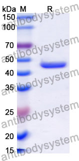 Recombinant Human ALKBH1 Protein, N-His