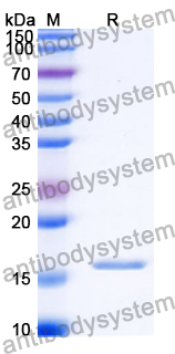 Recombinant Human MOGS Protein, N-His