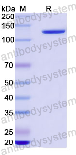 SDS-PAGE for Recombinant Human LAMB3 Protein, N-His ?>
