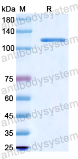 Recombinant Human LAMC2 Protein, N-His