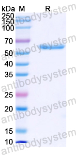 Recombinant Human LAMC2 Protein, N-His
