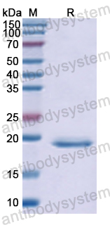 Recombinant Human SPTAN1 Protein, N-His