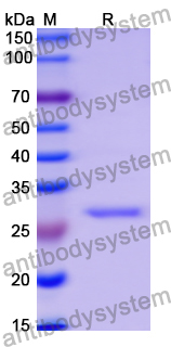 Recombinant Human IDI1 Protein, N-His