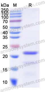 Recombinant Human RUNX2 Protein, N-His