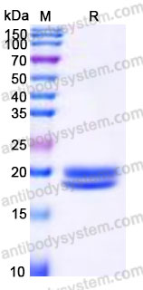 Recombinant Human IL16 Protein, Tag free