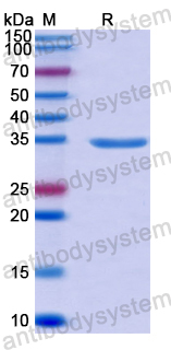 Recombinant Human SEPTIN6 Protein, N-His