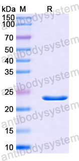 Recombinant Human TRIM14 Protein, N-His
