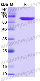 Recombinant Human TFDP1 Protein, N-GST