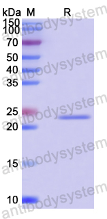 Recombinant Human FHL2 Protein, N-His-SUMO & C-Strep