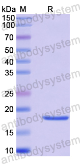 Recombinant Human MRPL58 Protein, N-His
