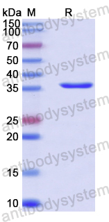 Recombinant Human EIF2B1 Protein, N-His