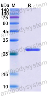Recombinant Human FZD2 Protein, N-His