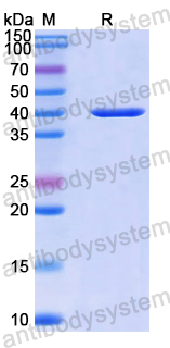 Recombinant Human GALE Protein, N-His