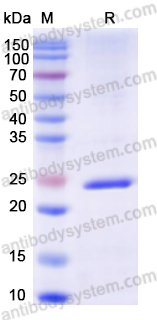 Recombinant Human RBM39 Protein, N-His