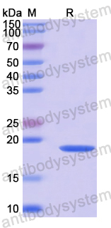 Recombinant Human SCN5A Protein, N-His