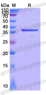 Recombinant Human DMC1 Protein, N-His