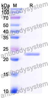 Recombinant Human SMC1A Protein, N-His