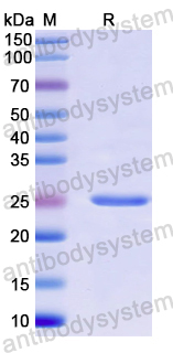 Recombinant Human USP10 Protein, N-His