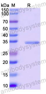 Recombinant Human LBR Protein, N-GST & C-His