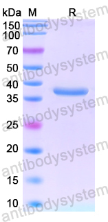 Recombinant Human KIF22 Protein, N-His