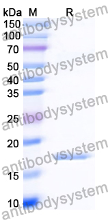 Recombinant Human LASP1 Protein, N-His