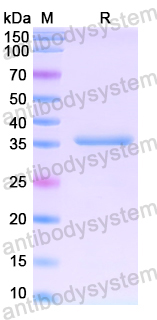 Recombinant Human CRYM Protein, N-His