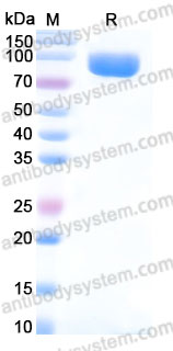 Recombinant Human KPNB1 Protein, N-His
