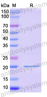 Recombinant Human HEPACAM Protein, N-His