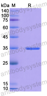 Recombinant Human NCAPH Protein, N-GST & C-His