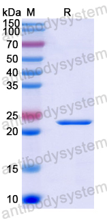 Recombinant Human HERPUD1 Protein, N-His-SUMO & C-Strep