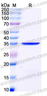 Recombinant Human MORF4L2 Protein, C-His