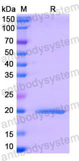 Recombinant Human LARS2 Protein, N-His