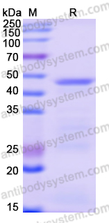 Recombinant Human SNX17 Protein, N-His