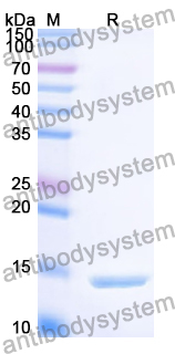 Recombinant Human RAB3GAP1 Protein, N-His